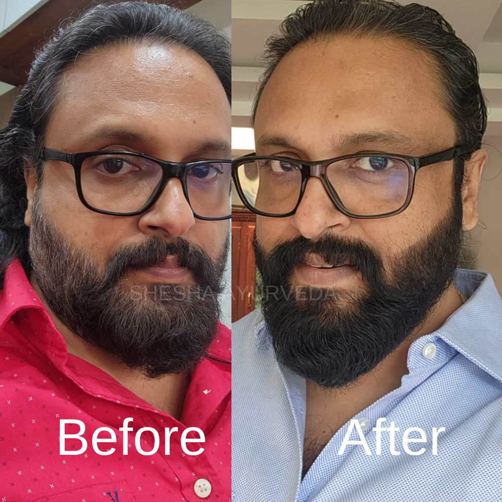 Beard Colour – Natural Black